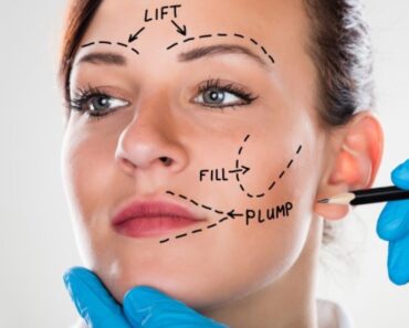 A face lift can make it look slimmer and more youthful