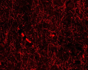 Accidental discovery hints at mysterious structures in our brains