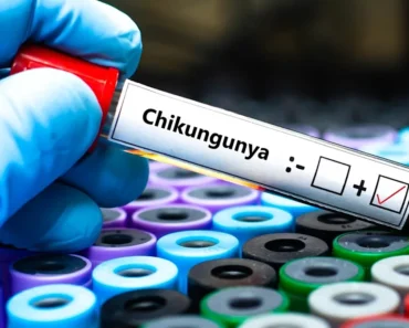 Bavarian Nordic and SII sign agreement to produce chikungunya vaccine