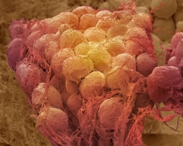 Cells in the body remember obesity. Here’s what that means for weight loss