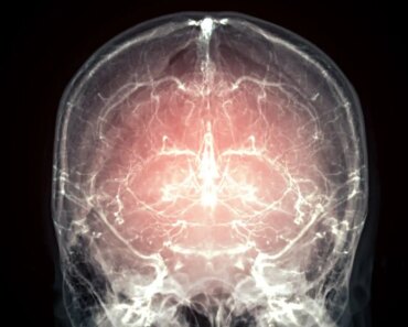 Great leap towards resuscitation after death as the mammalian brain is preserved Great leap towards resuscitation after death as the mammalian brain is preserved