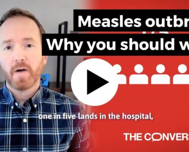 Measles’ resurgence in the United States is a grim sign of things to come Measles’ resurgence in the United States is a grim sign of things to come