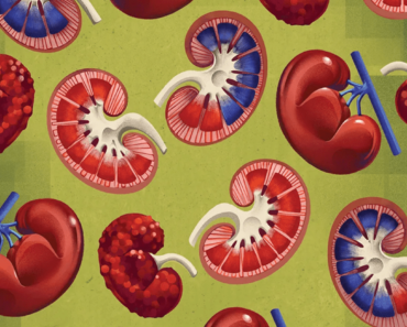 New medicines and treatments are changing kidney care