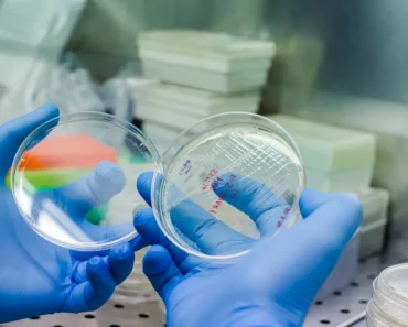 Relieve to receive candidacy treatment