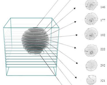 Scientists use CT scans to examine giant hailstones