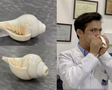 Study finds that blowing conch shells reduces sleep apnea symptoms