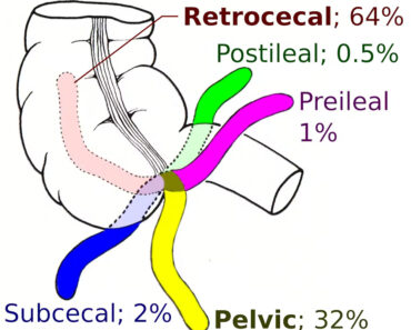 The appendix evolved at least 32 times across 361 species, so it’s ‘unlikely to be a useless evolutionary accident,’ research finds The appendix evolved at least 32 times across 361 species, so it’s ‘unlikely to be a useless evolutionary accident,’ research finds